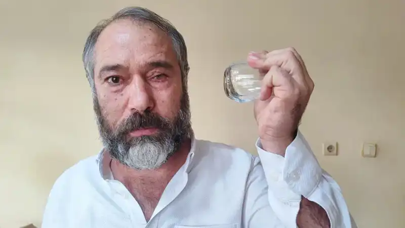 Çaycıya Küfür Eden Müşteri, Uyarı Sonrası Şiddete Uğradı: Bir Gözünü Kaybetti!