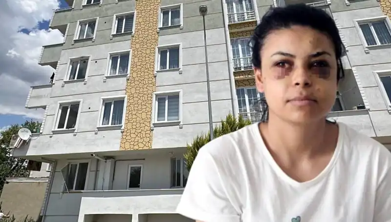 Düğünde Magandanın Kurbanı Olan Genç, Gözüne İkili Saçmalardan Saldırdı!